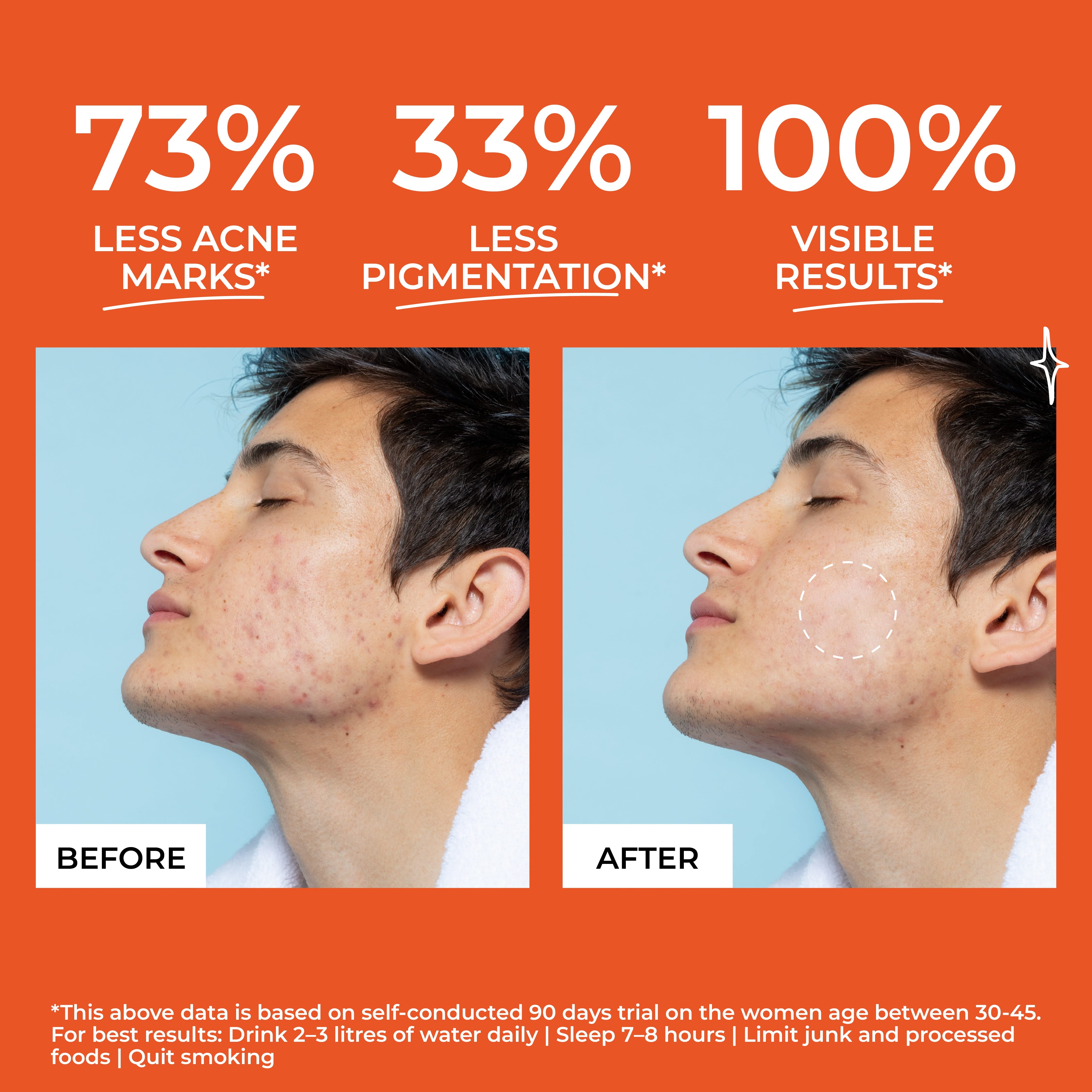 Be Odd Beyond Skin Acne Skin Supplement - 30 counts.