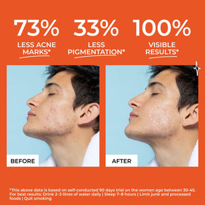 Be Odd Beyond Skin Acne Skin Supplement - 30 counts - Health N Wellness Shop