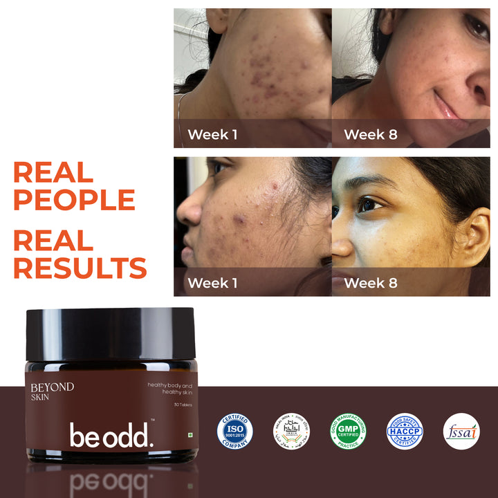 Be Odd Beyond Skin Acne Skin Supplement - 30 counts.